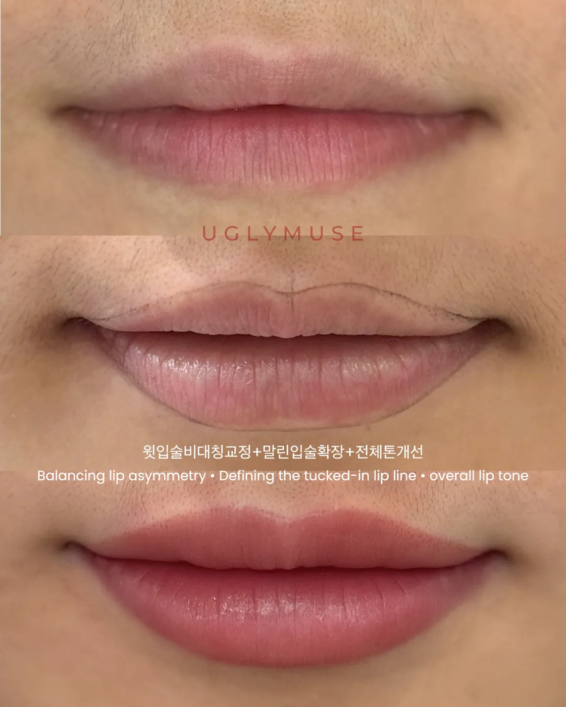 비포 · 애프터 · 어글리뮤즈 UGLYMUSE
